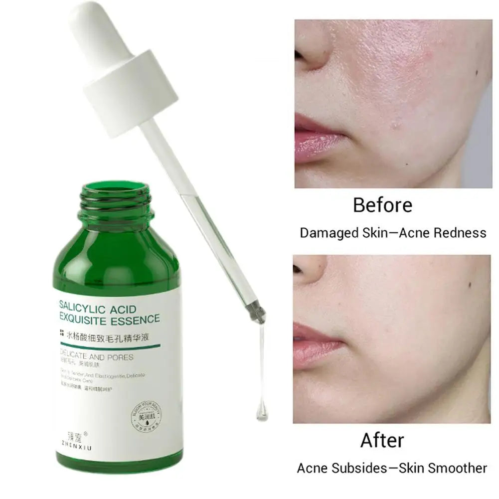 Iceybutnice™ Pore Cleansing Essence