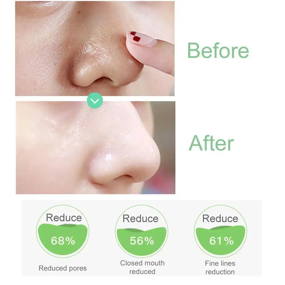 Iceybutnice™ Pore Cleansing Essence