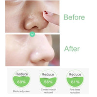 Iceybutnice™ Pore Cleansing Essence